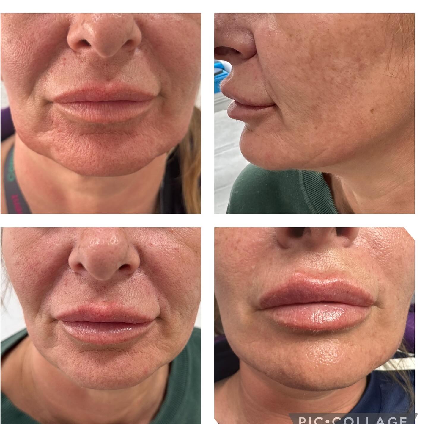 469416370_18291621019238152_2485307494004402918_n