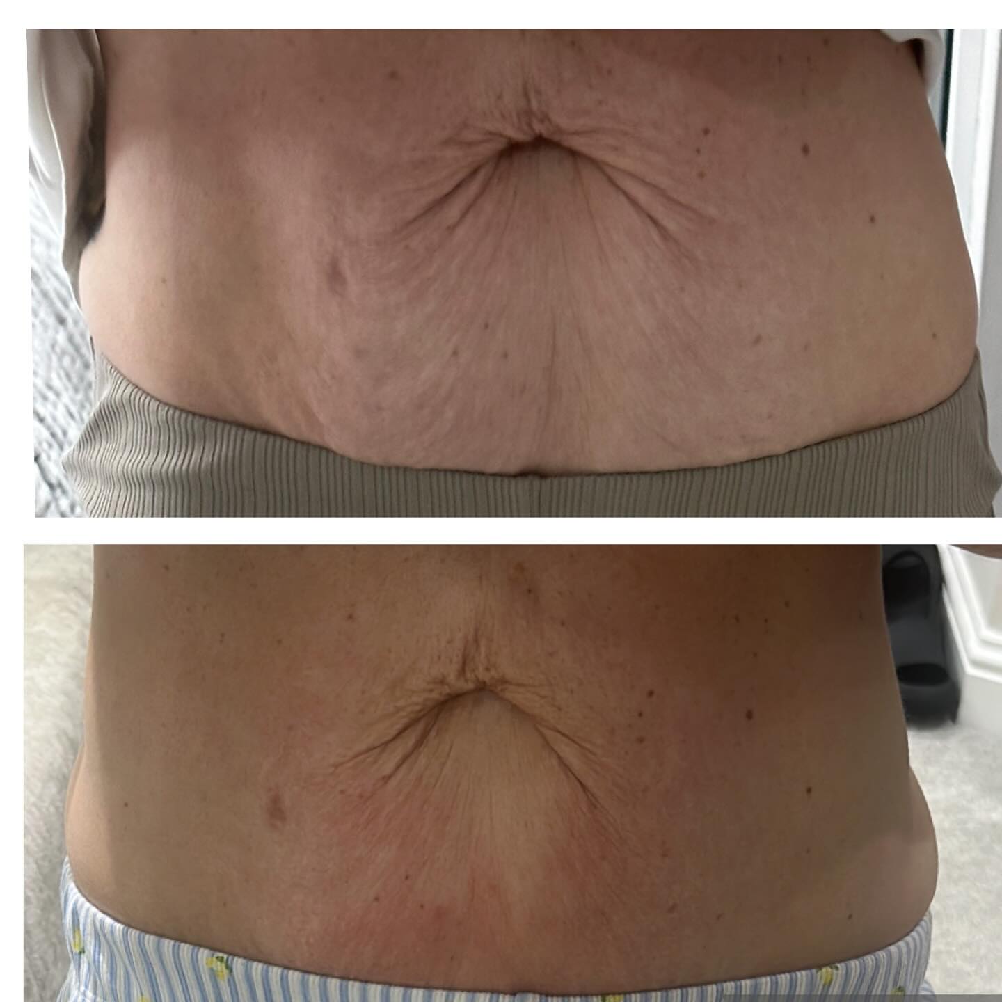 525133189_18318879337238152_5078013328476960090_n