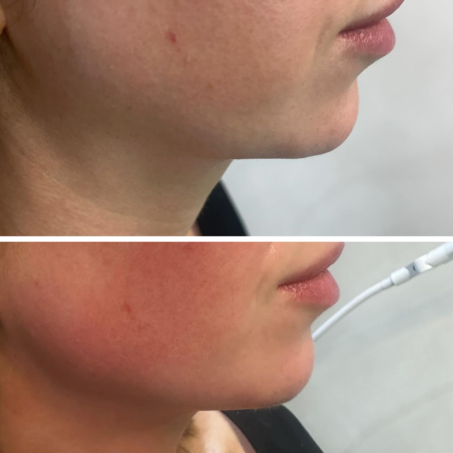 574663279_18333066331238152_1493247950356697267_n