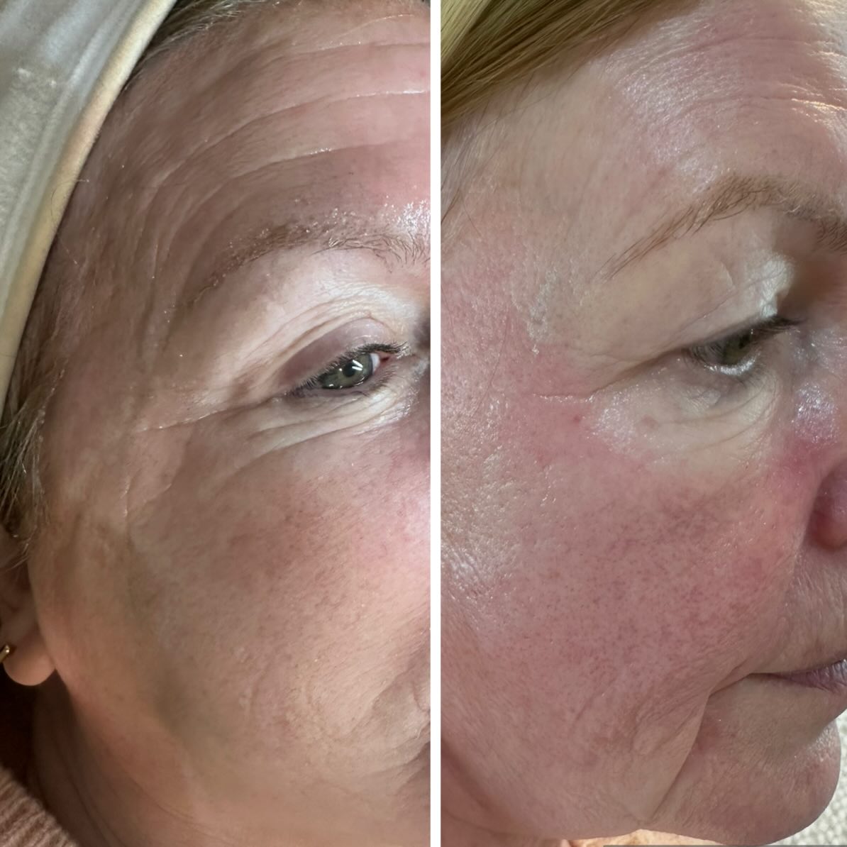 623277265_18342761383238152_1687243586743745756_n