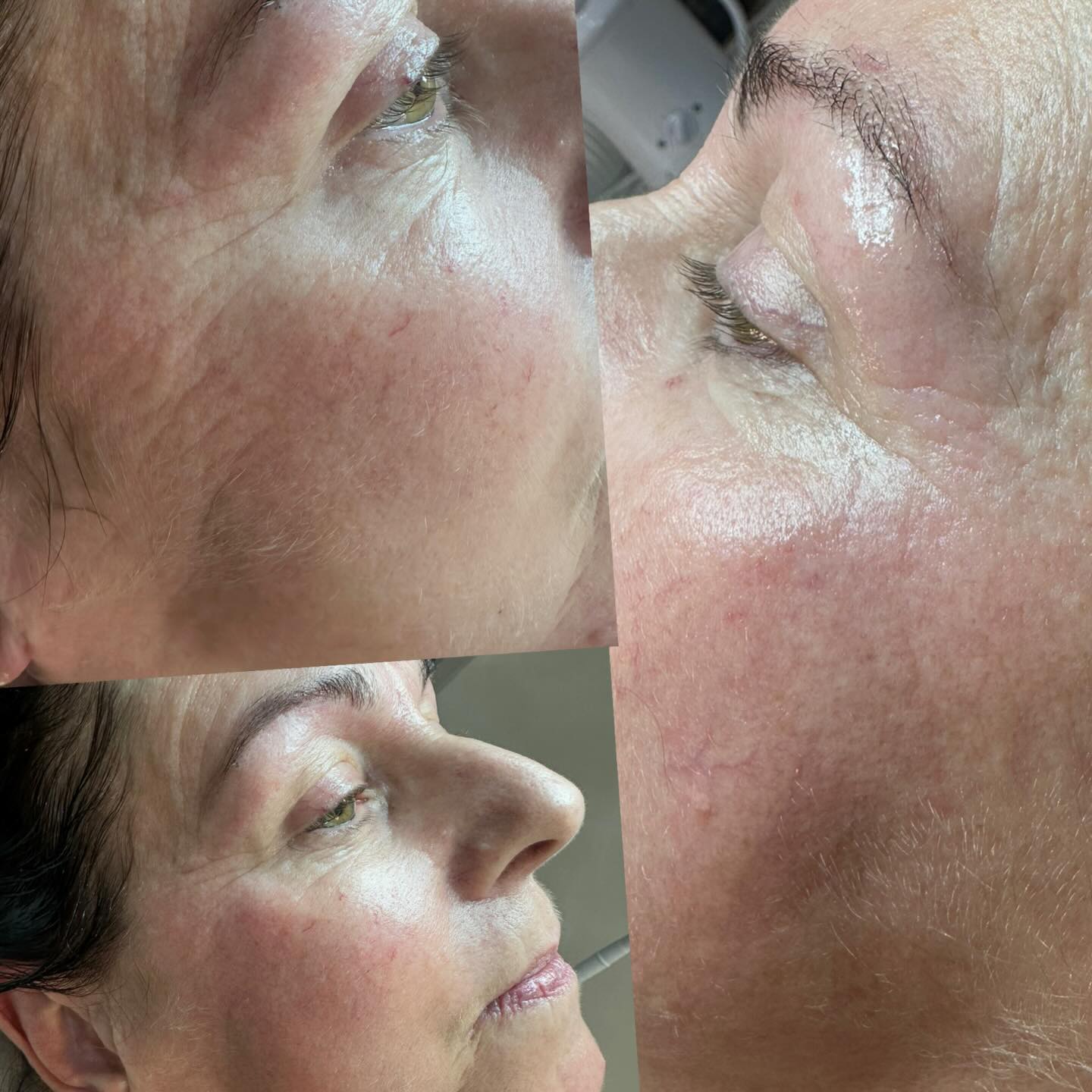 629849098_18344728120238152_8451693520036688954_n